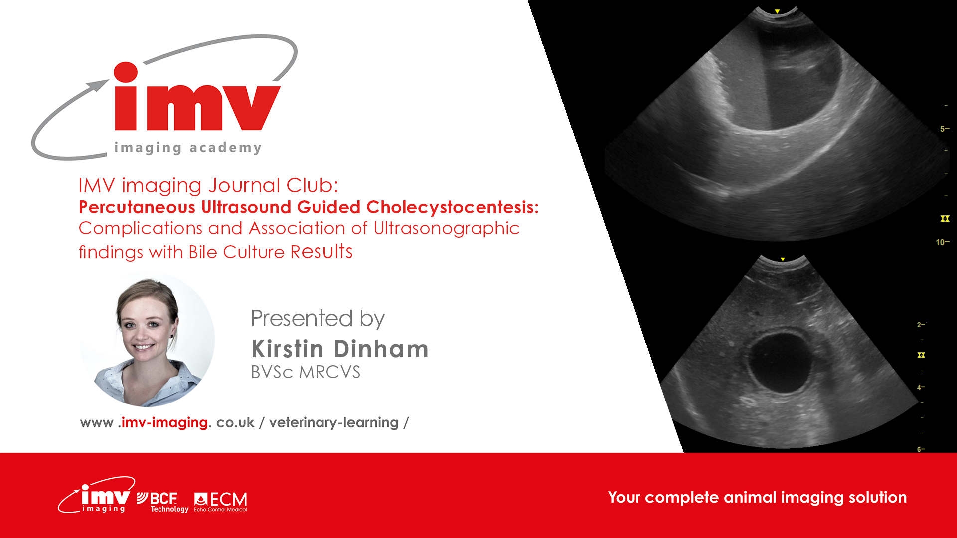 KD Percutaneous Ultrasound Guided Cholecystocentesis Complic